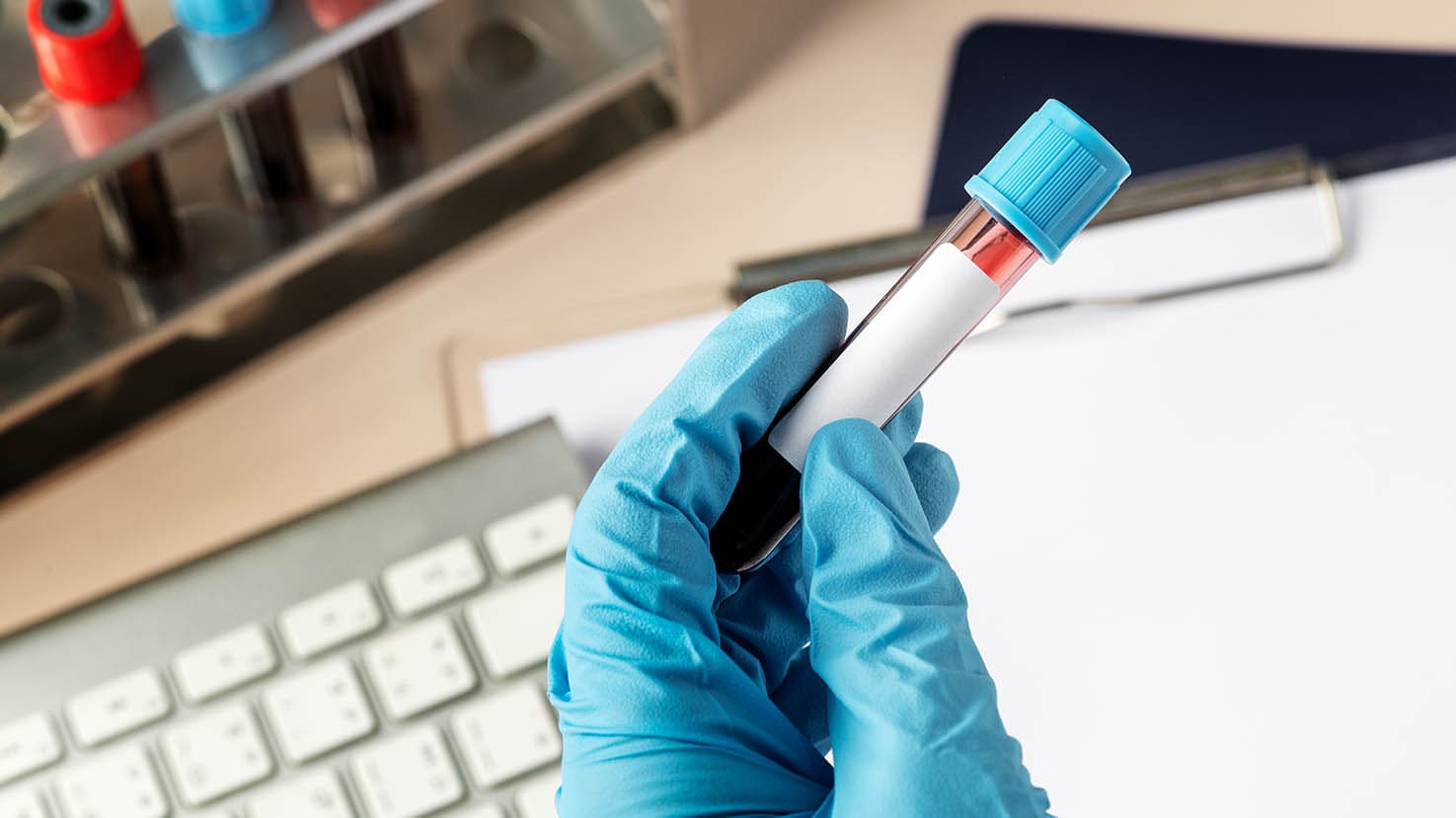 surgeon-holding-blood-test